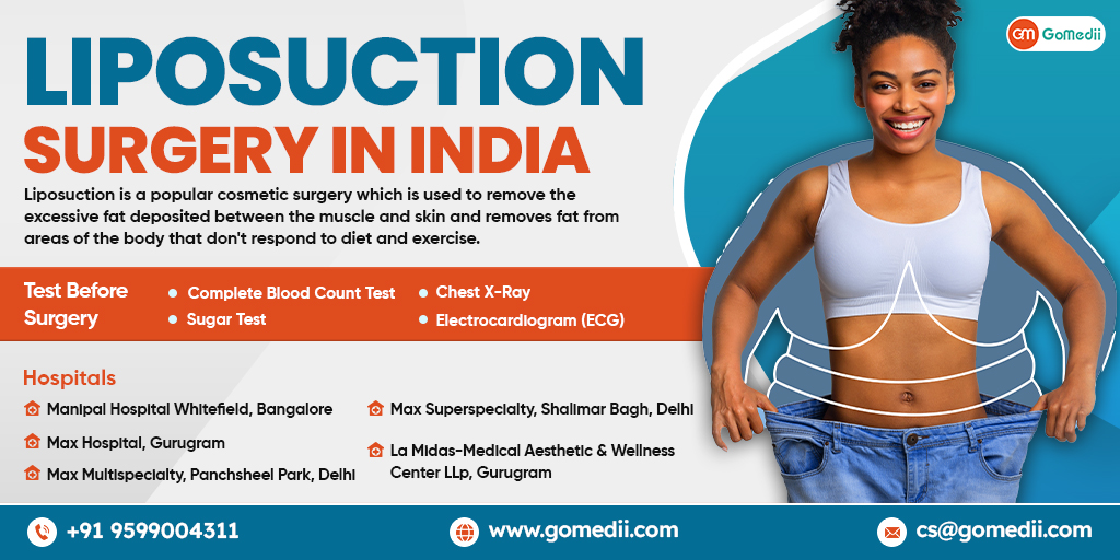 Liposuction surgery in India