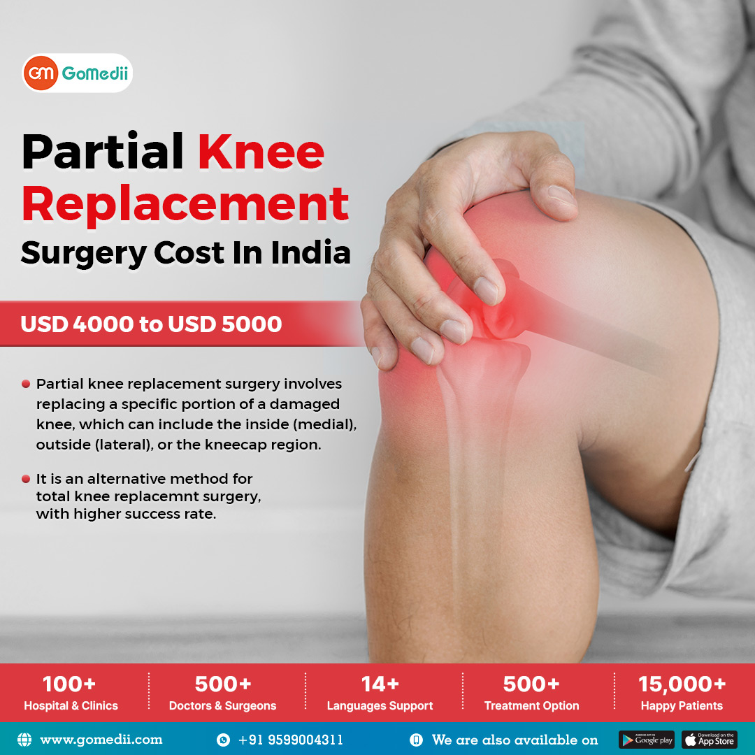 Partial Knee Replacement Surgery Cost In India