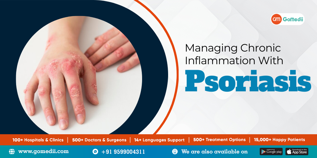 Managing chronic inflammation with psoriasis