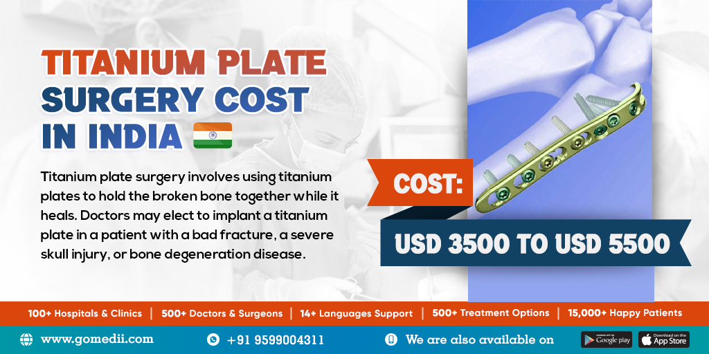 Titanium Plate Surgery Cost In India - GoMedii