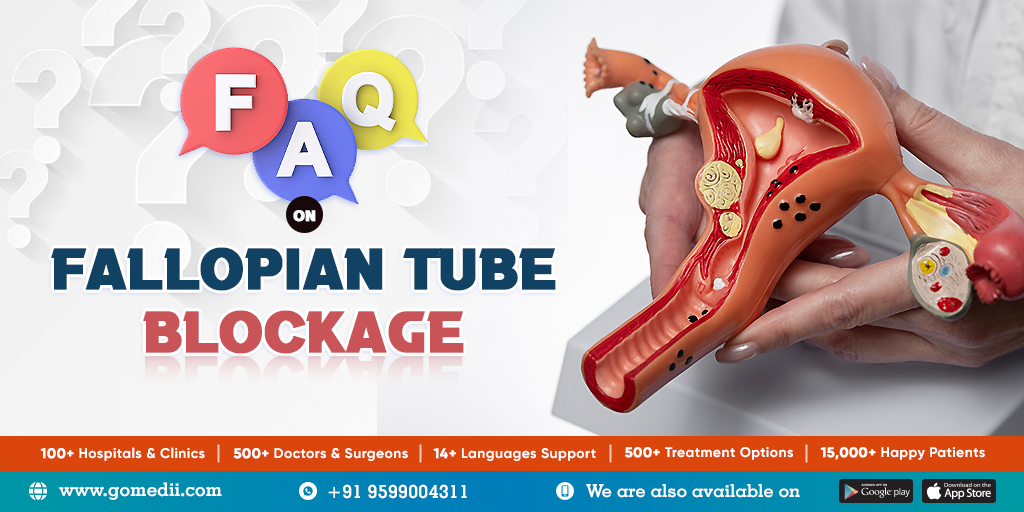 FAQs Session On Fallopian Tube Blockage With Dr. Reena Gupta - GoMedii