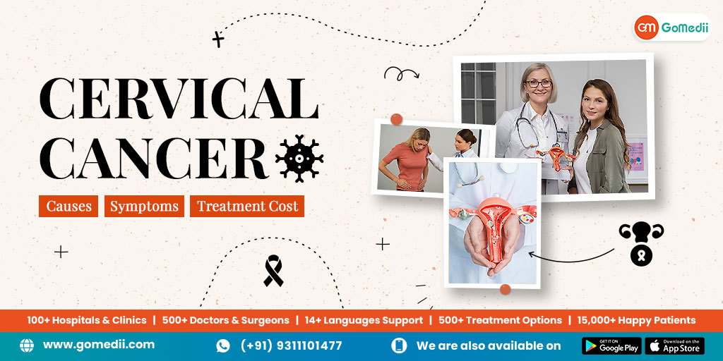 cervical cancer treatment in India