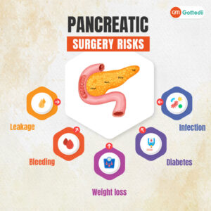 Risks of Pancreatic Cyst Treatment
