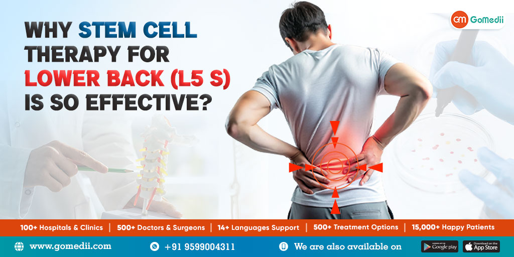 stem cell therapy for lower back