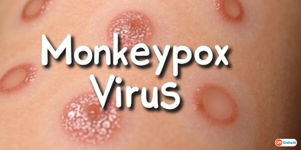 What's Mpox Clade Ib, how does it spreads?