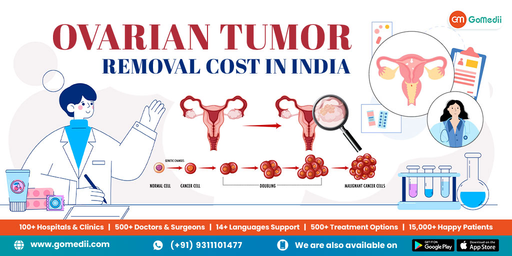 Ovarian Tumor Removal Cost in India