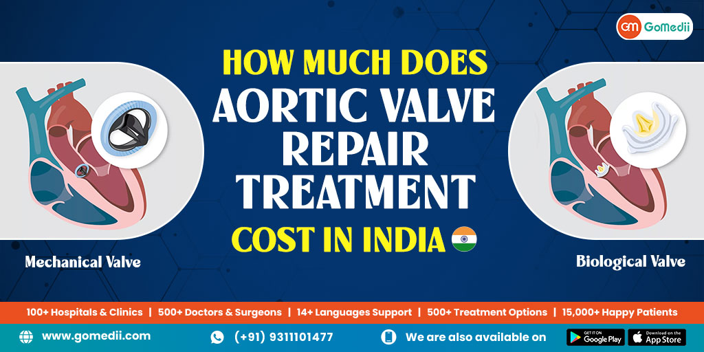 How Much Does Aortic Valve Repair Treatment cost in India