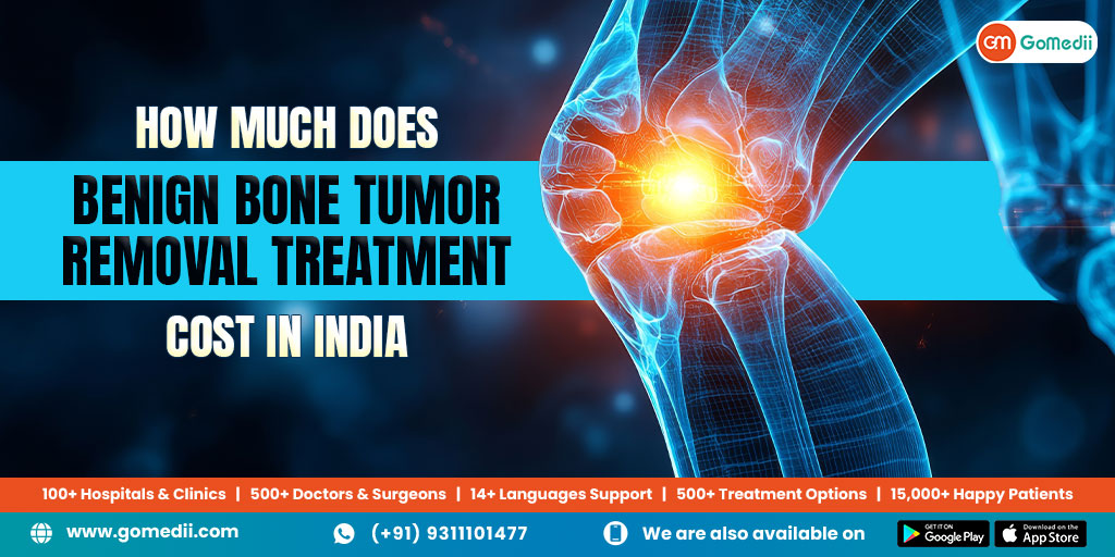 How Much Does Benign Bone Tumor Removal Treatment cost In India