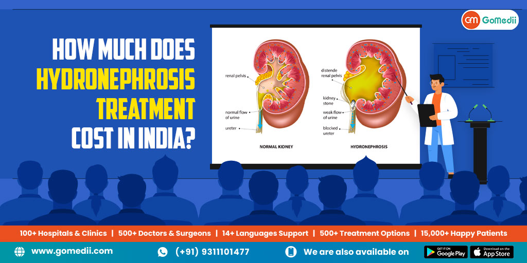 Hydronephrosis Treatment cost in India