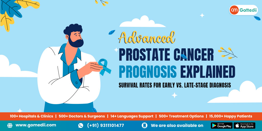 Advanced Prostate Cancer Prognosis Explained: Survival Rates for Early vs. Late-Stage Diagnosis