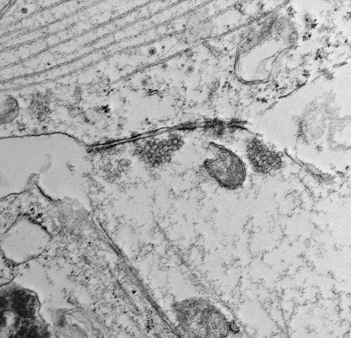Electron micrograph of a synapse: two clusters of small round vesicles along the junction between two cells, beside a mitochondrion.