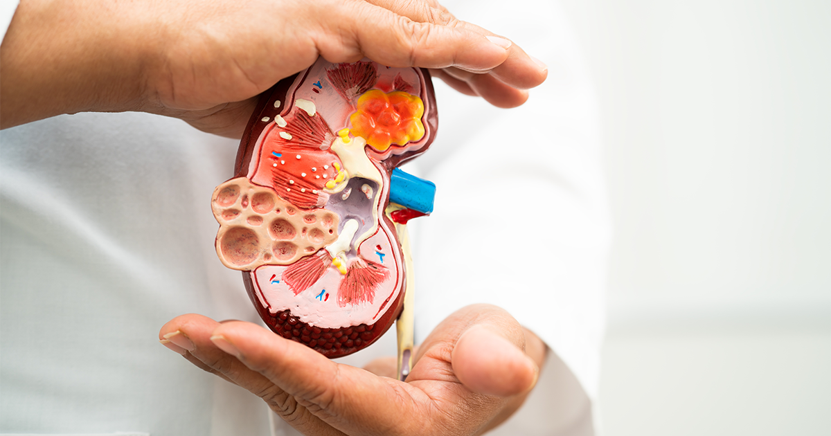 What is chronic kidney disease?
