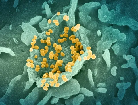 La Vida Después del Hantavirus: Impacto y Recuperación