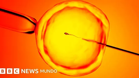 Una nueva técnica ayuda a hombres con infertilidad