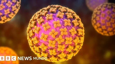 El hantavirus y su impacto en la salud pública en Argentina