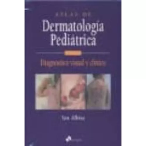 Atlas De Dermatologia Pediatrica: Diagnostico Clinico Por Imagen