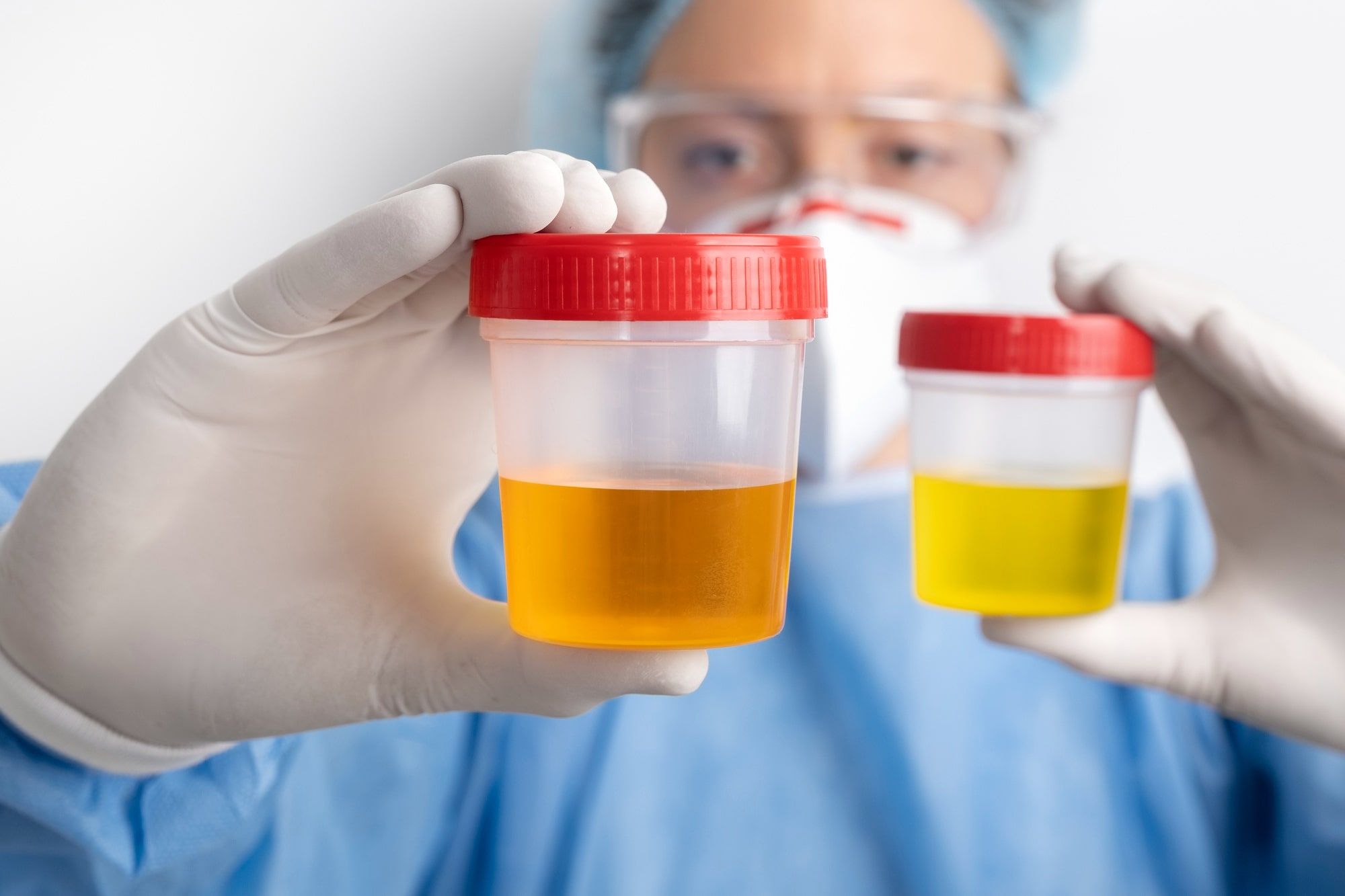 Why is there mucus in my urine?