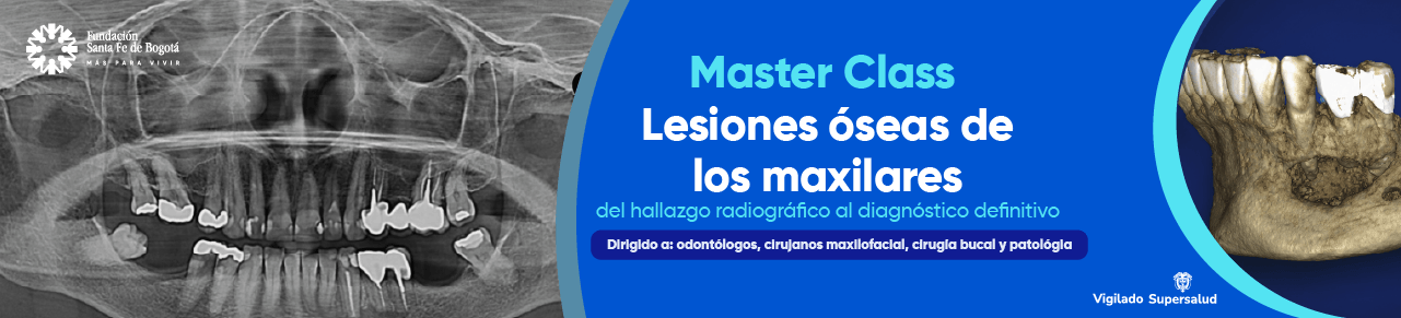 Master Class: Lesiones Óseas de los Maxilares, del Hallazgo Radiográfico al Diagnóstico Definitivo