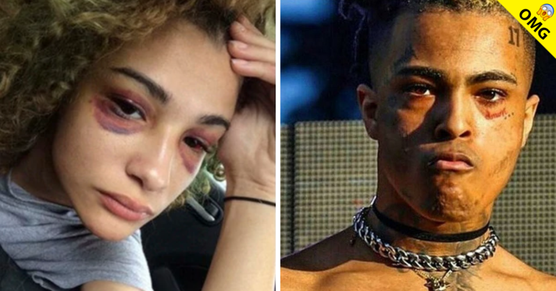 Filtran Audio De Xxxtentacion En Donde Confiesa Sus Crímenes Exa Fm 