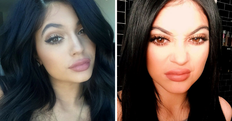 OMG! Así lucen los labios de Kylie Jenner sin ser inyectados