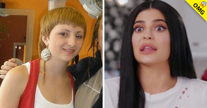 Chica se opera para parecerse a Kylie tras sufrir bullying