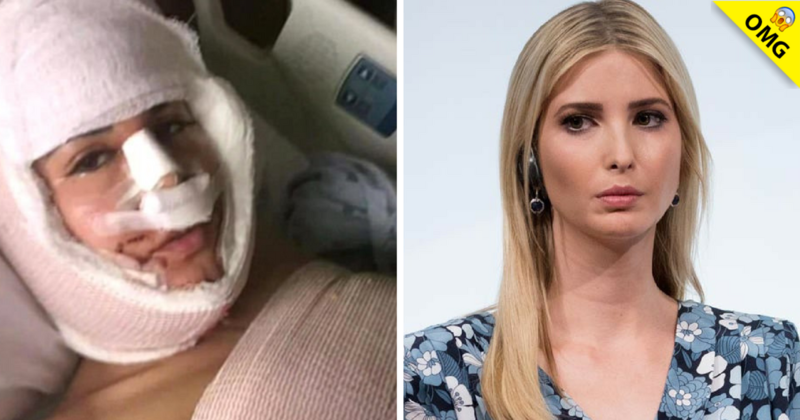 Tiffany se opera 13 veces  para parecerse a Ivanka Trump