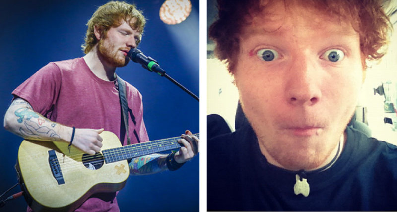 ¡Ed Sheeran casi pierde un ojo por ésta razón!