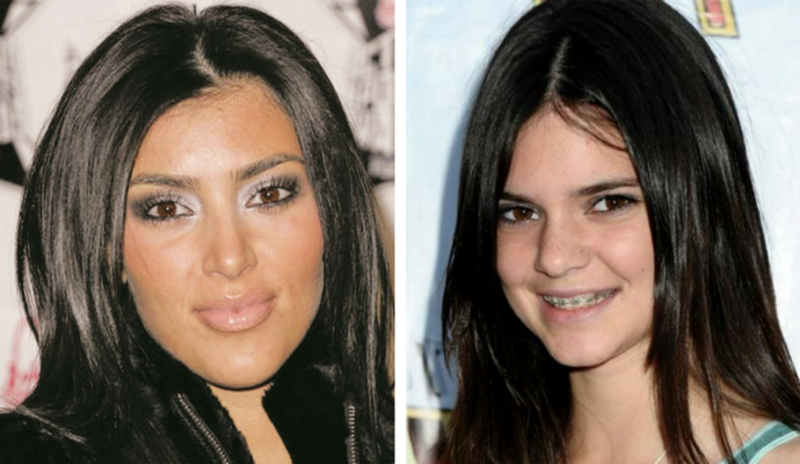 Las Kardashian antes de conocer el quirófano.