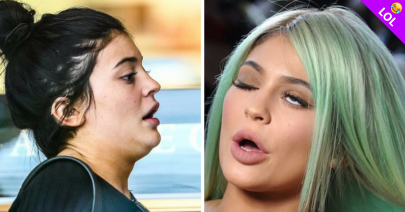 Las diez peores fotos que le han tomado a Kylie Jenner.