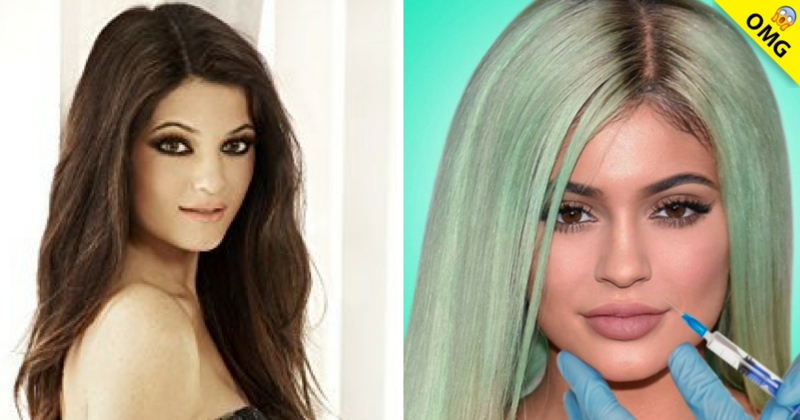 Kylie Jenner se quita el relleno y no la reconocerás