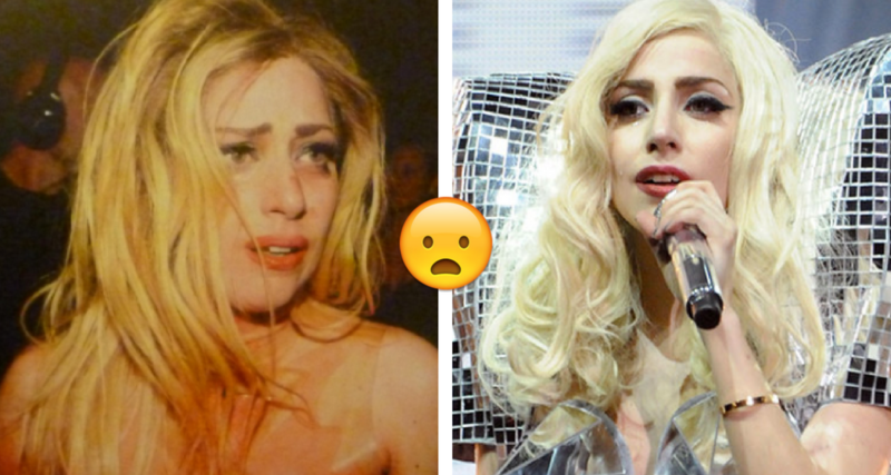 ¡Lady Gaga tiene esta terrible enfermedad!