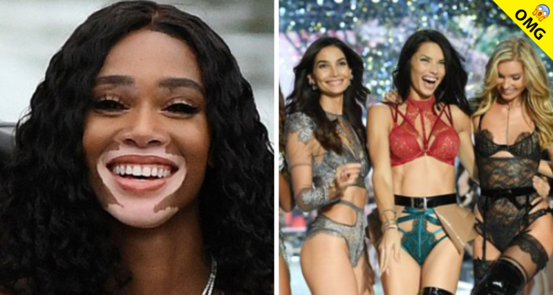 Winnie Harlow, primera modelo con vitiligo en Victoria’s Secrets