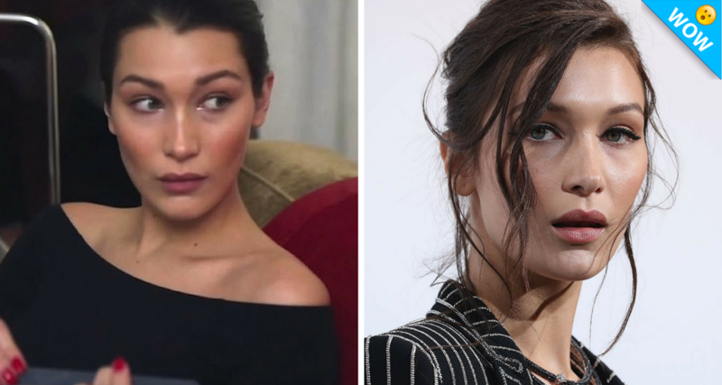 Cirujano plástico habla sobre las operaciones de Bella Hadid