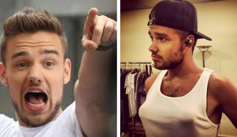 Liam Payne sufre una terrible deformidad.