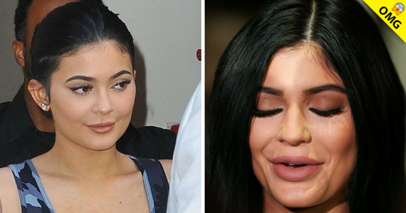 ¿Kylie Jenner se volvió a rellenar los labios?