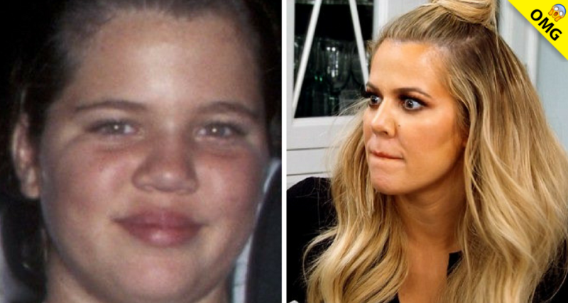 La increíble transformación de Khloé antes de las cirugías