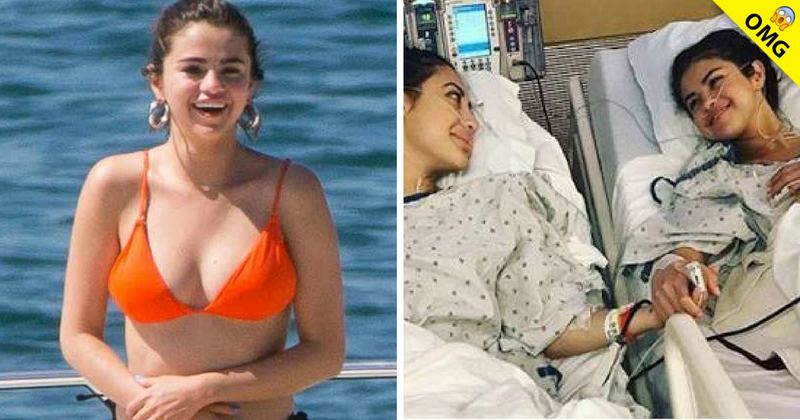 Selena Gómez muestra la cicatriz que le dejó su transplante.