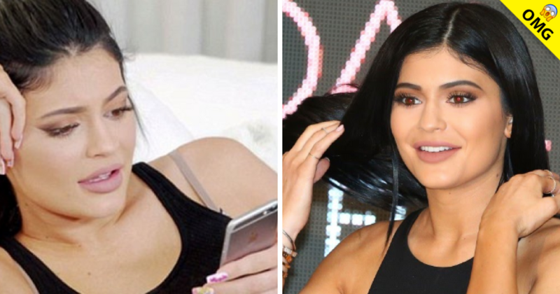 Las fotos que Kylie no quisiera que veas antes de sus cirugías