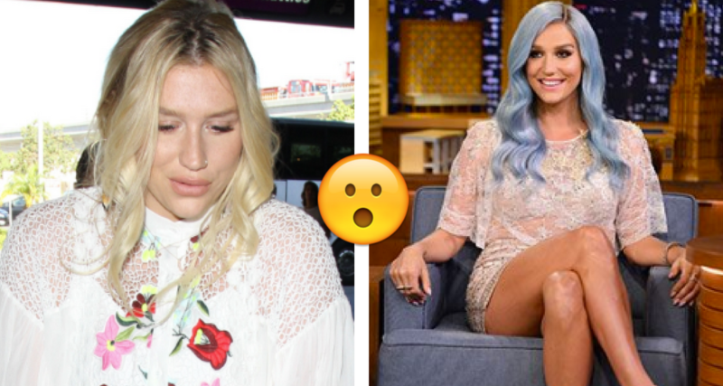 OMG! ¡Kesha impacta con aumento de peso!