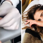 Michelle Renaud comparte cómo le borraron sus tatuajes