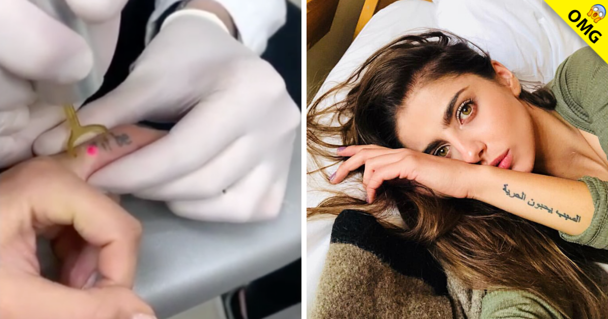 Michelle Renaud comparte cómo le borraron sus tatuajes