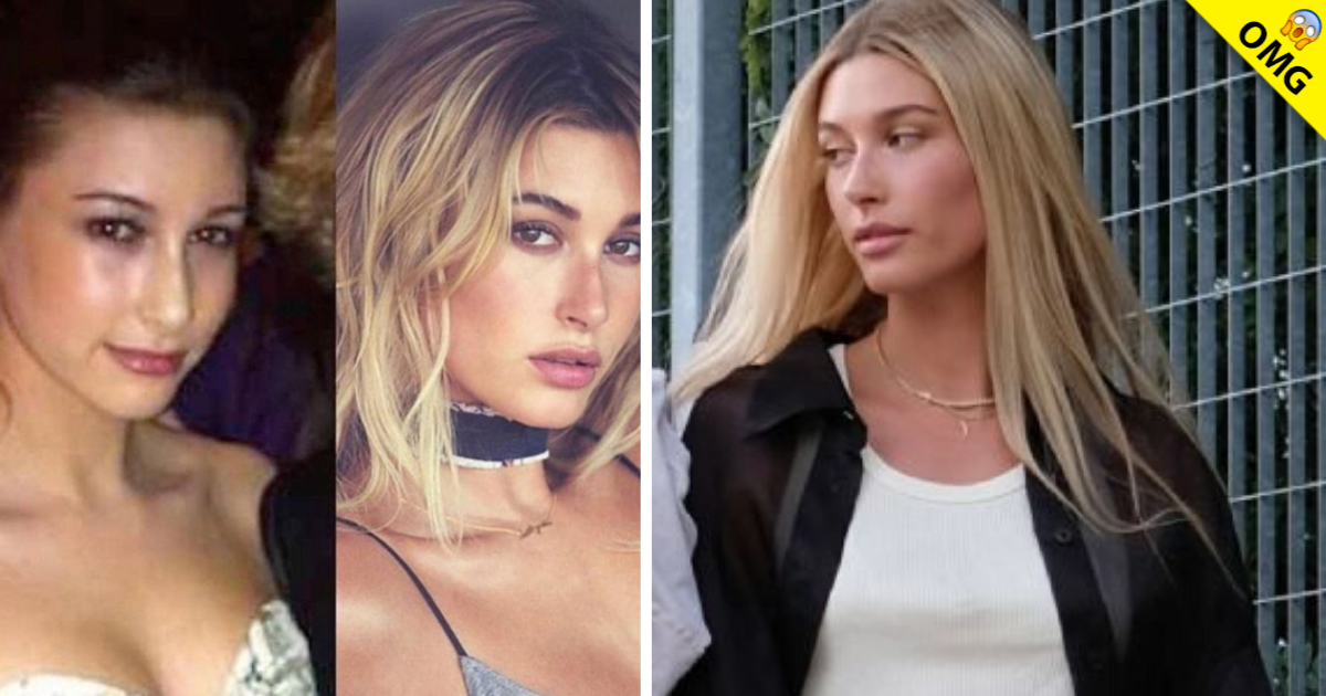 Hailey Baldwin responde si se ha hecho cirugías