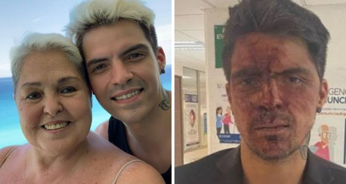 Cesar D’Alessio se somete a cirugía de reconstrucción facial, tras golpiza que recibió