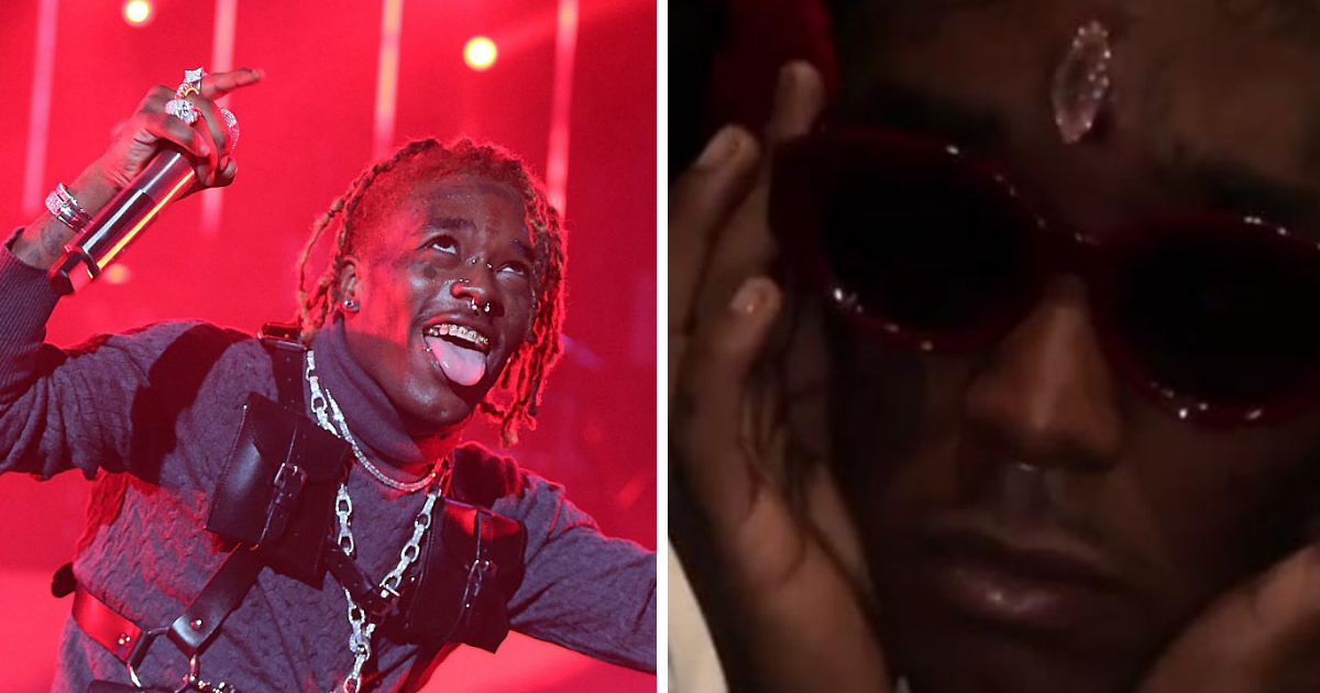 Lil Uzi Vert se incrusta diamante de 24 millones en su frente