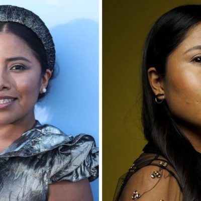 Yalitza Aparicio revela que padece enfermedad en la piel