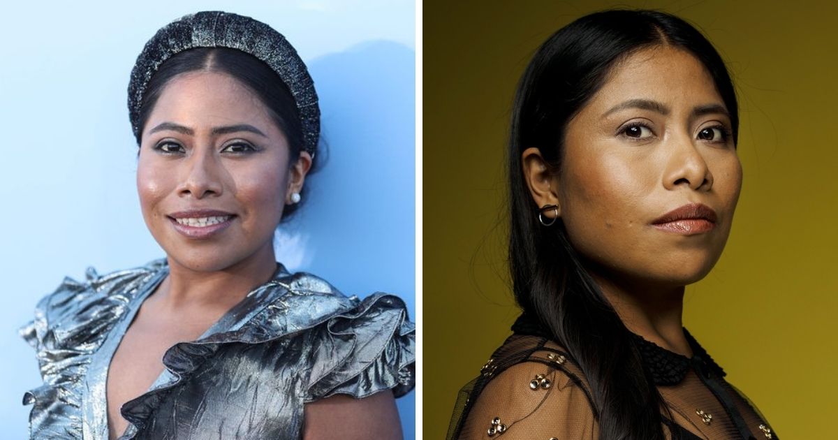 Yalitza Aparicio revela que padece enfermedad en la piel