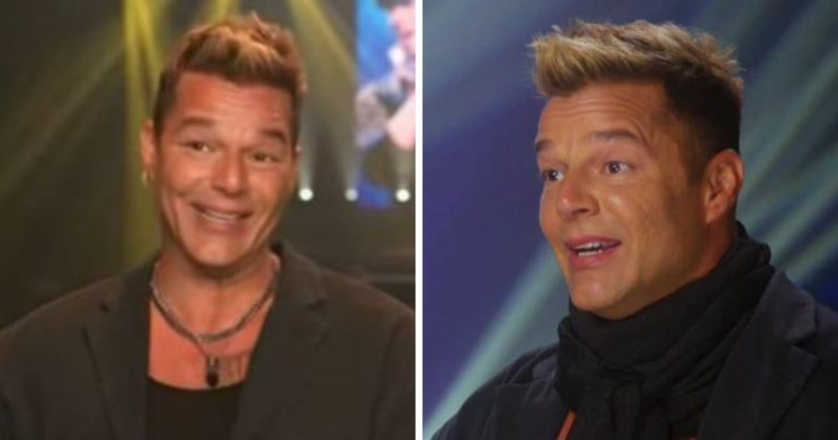 ¿Alergia? Revelan que Ricky Martin no se hizo cirugía en el rostro