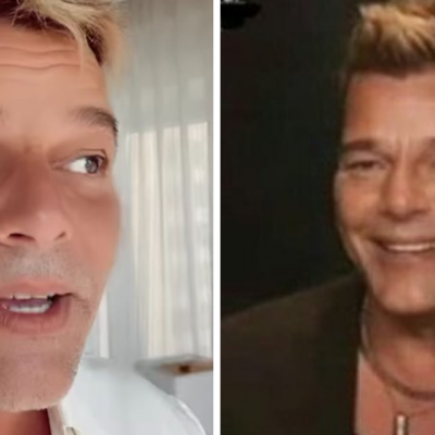 Ricky Martin revela lo que realmente le sucedió a su rostro