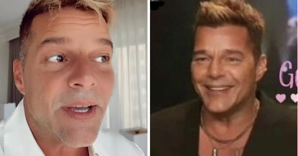 Ricky Martin revela lo que realmente le sucedió a su rostro