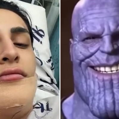 Comparan a Kunno con Thanos tras cirugía estética y él responde